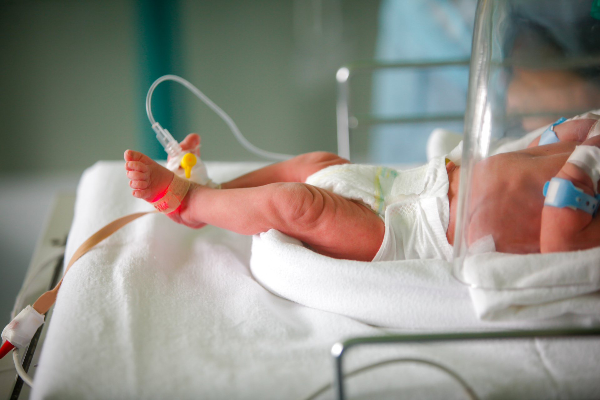 Infant baby with complications